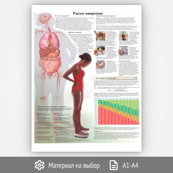 Плакат «Риски ожирения» (ЗОЖ-18, 1 лист)
